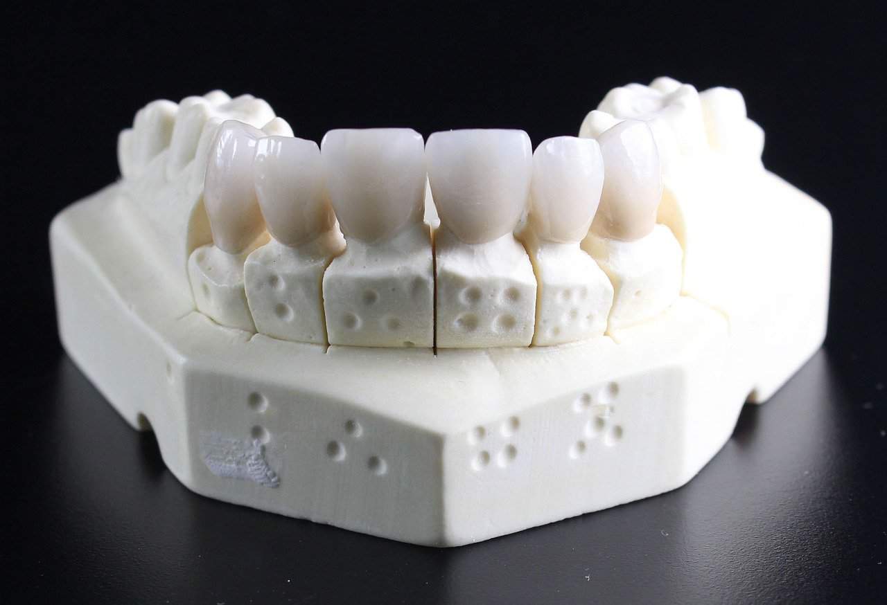 Braki zębowe – jak je uzupełnić?